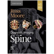 diagnostic-imaging-spine