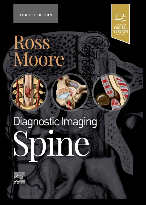 diagnostic-imaging-spine