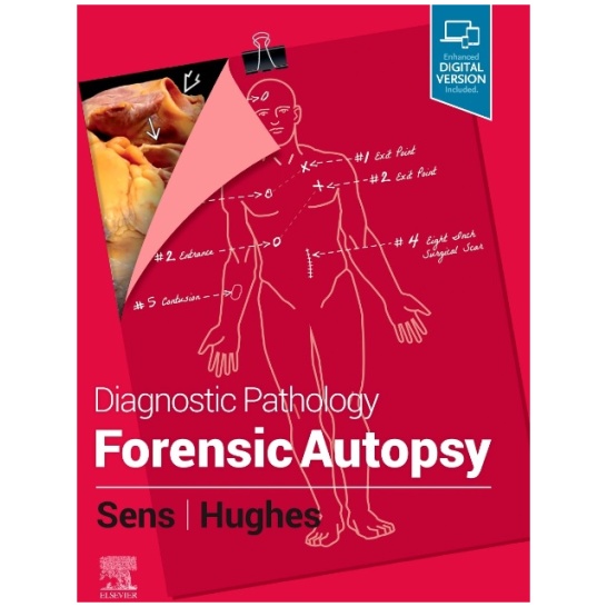forensic autopsy