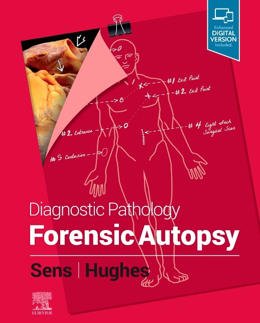 forensic autopsy